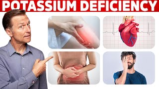 Low Potassium Signs Symptoms Causes and Treatment [upl. by Ttayh270]