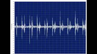 Tracking in HV Insulator Time Series View [upl. by Saimon]