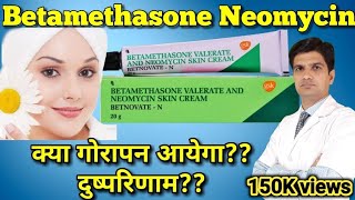 Betnovate N cream  Betamethasone Neomycin cream  betnovate n skin cream [upl. by Atirys]