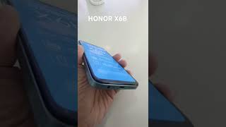 Honor X6B New Design Phone honor technology new [upl. by Ajed123]