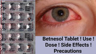 Betnesol Tablet  Betamethasone  Use  Dose  Side Effects  Precautions [upl. by Heywood]