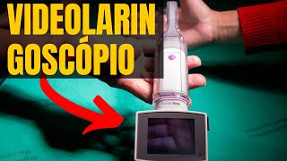 Videolaringoscópios dicas e conselhos práticos AirTraq CMAC McGrath Glidescope [upl. by Learsiy578]