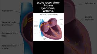 Hyperventilation differentials [upl. by Immac883]