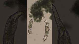 Rotifers Feeding [upl. by Yrogreg]