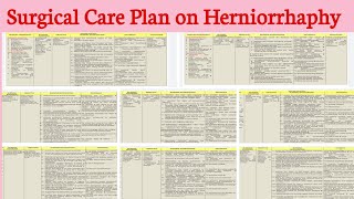 NCP 25 B Surgical Care Plan on Herniorrhaphy GI disorders [upl. by Grizelda423]