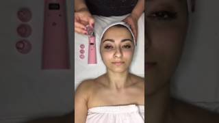 How to use a quotComedone Suction Devicequot in facials [upl. by Akiras317]