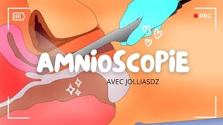 Amnioscopie [upl. by Schonthal932]