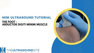 MSK ultrasound evaluation of the abductor digiti minimi muscle [upl. by Anrahs]