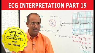 EKG or ECG Interpretation  Part 1920 [upl. by Notnelc]