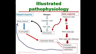 Pathophysiology of Asthma Illustrated [upl. by Wilt501]