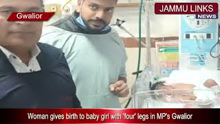 Woman gives birth to baby girl with four legs in MPs Gwalior [upl. by Airdnekal889]