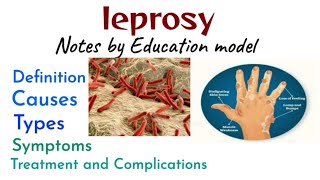 Leprosy notes  intro  Causes  Types  symptoms  Treatment  Complications  Education model [upl. by Yael]