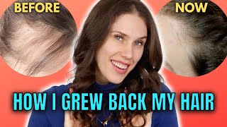 10 Best amp Worst Hair Growth Treatments That I’ve Tried At Home [upl. by Malanie]