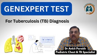 GeneXpert or CB NAAT test for Diagnosis of Tuberculosis I Dr Ankit Parakh Child TB Specialist [upl. by Burnight]