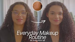 natural everyday makeup for acne prone skin [upl. by Tingey]