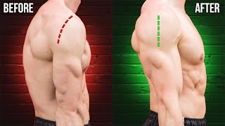 How I Fixed Rounded Shoulders Forever [upl. by Rowell]