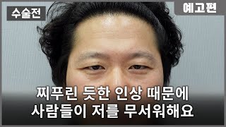 ENG SUB 길고 깊은 눈초리주름 자주 짓물러져서 정말 불편해요  닥터첫번째 인터뷰 공식 예고편 [upl. by Lennod]