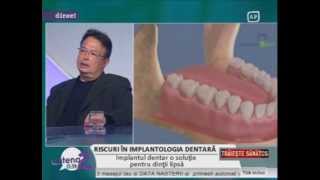 Riscuri in implantologia dentarawmv [upl. by Anerres81]