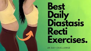 Heal amp Flatten With These Daily Diastasis Recti Exercises [upl. by Olonam]