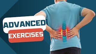 Spondylolisthesis ADVANCED EXERCISES for active people [upl. by Atiz]