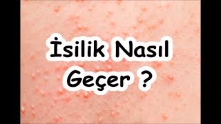 İsilik Nasıl Geçer [upl. by Ettennil]