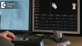 How is electrophysiology study done  Dr Mohammed Haroon Rashid [upl. by Adonis]