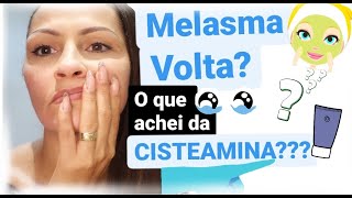 MELASMA RESULTADO DA CISTEAMINA [upl. by Eirot455]