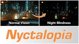 Night Blindness Nyctalopia  Causes amp Treatments [upl. by Lahcear643]