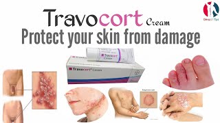 Travocort cream benefits and full review in UrduHindi [upl. by Doner]