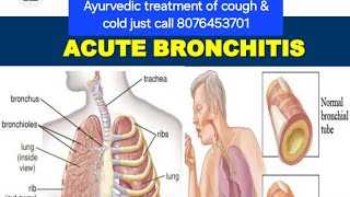 CoughColdBronchitisAcute bronchitisYtm AyurvedaAyurvedaYtm indiaNatural healingNatural herbs [upl. by Gloriana]