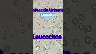 Leucocitos bajo el microscopio infección Urinaria Infección infecciónurinaria orina bioanálisis [upl. by Eybbob]