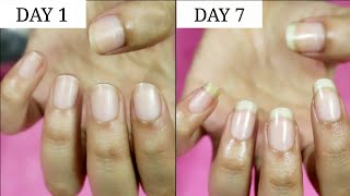 7 Days Nail Growth Challenge  Riya Beauty [upl. by Dinsdale]