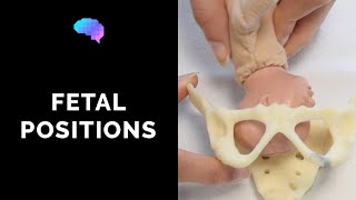 Types of Fetal Positions  OSCE Guide  UKMLA  CPSA [upl. by Matheson]