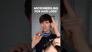 Microneedle go for hair loss [upl. by Ahseeyt]