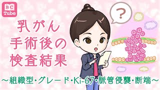 【病理後編】乳がん手術後の検査結果～組織型、グレード、Ki67、脈管侵襲、断端～ 《BC Tube：乳癌の専門家による情報発信グループ》 [upl. by Favien928]