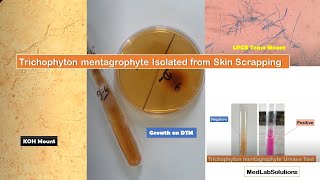 Trichophyton mentagrophyte isolated from clinical sample Skin Scrapping [upl. by Trev]