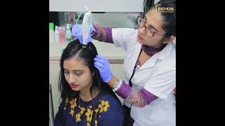 চুল পড়ার সমস্যা সমাধানে আছে Advanced EPN Treatment hairtreatment bioxincosmeceuticals [upl. by Graig]