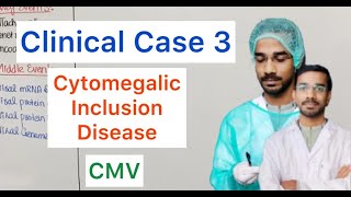 Clinical Case 3  Cytomegalic Inclusion Disease  CMV [upl. by Key]