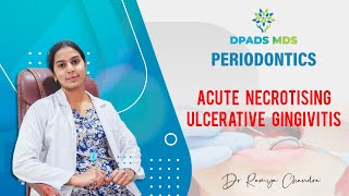 Acute Necrotising Ulcerative Gingivitis  Periodontics  Dr Ramya Chandra  DPADS MDS [upl. by Sargent94]