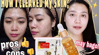 BEAUTEDERM FINAL REVIEW  PROS AND CONS  May Santos [upl. by Devinne716]