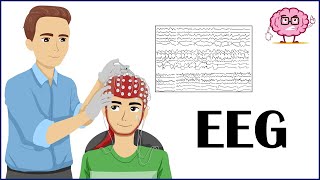 EEG Electroencephalogram  How It Is Done Indications Types Of EEG  Patient Education [upl. by Ronica]