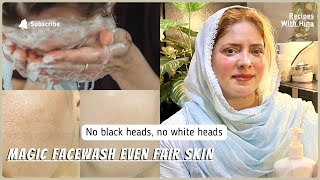 Fair Even Skin Tone  Black Heads Gone  Magic Face Wash  Instant Glowing Skin [upl. by Schilling707]