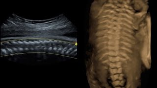 Detaylı ve dört boyutlu 4d ultrasonografi 21 haftalık gebelik ve renkli Doppler nasıl yapılır [upl. by Stewart]