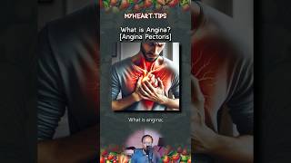 What is Angina Angina Pectoris [upl. by Ricky90]