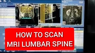 Lumbar Spine MRI scan Protocol positioning and planning  Live Demo on GE 15 Tesla [upl. by Kilar]