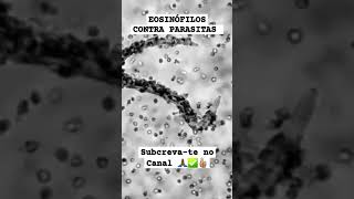 EOSINÓFILOS CONTRA PARASITAS 😱 Biomedicina laboratory imunidadebaixa [upl. by Kcirej]