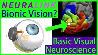 Can Neuralink Cure Blindness Superhuman Vision Brain Implant vs Retinal Implant [upl. by Carmelita]