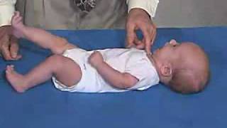 Neurology Exam 3 Month Primitive ReflexesRoot [upl. by Kasey]