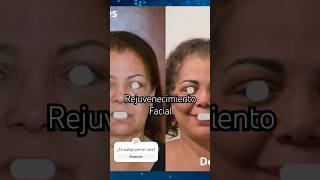 ¿Rejuvenecimiento facial lo necesitaslifting liftingfacial rejuvenecimientofacial rejuvener [upl. by Sliwa527]