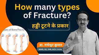 Common types of Bone fracture  Types of Fracture  How many types of Fracture fracture [upl. by Parthinia234]